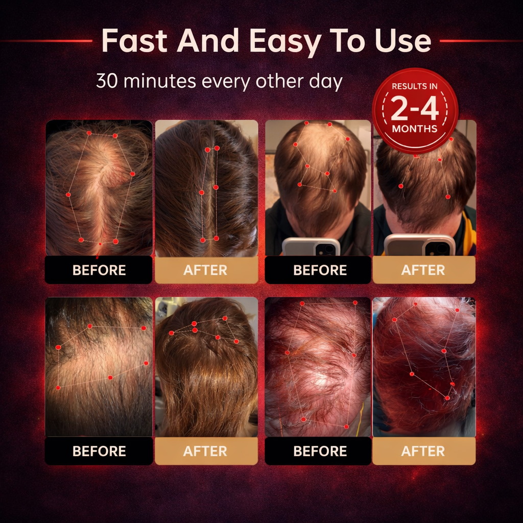 🔥Last Day:63% off 🔥Red Light Therapy Regrowth Cap